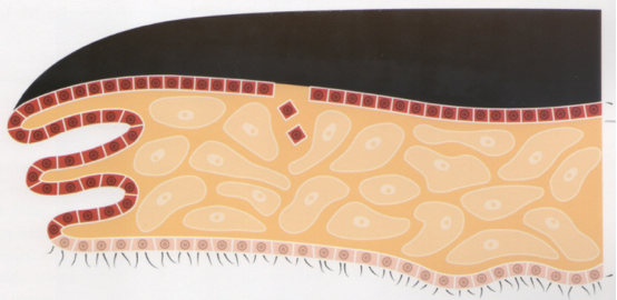 Sac perlier en formation dans les tissus du mollusque